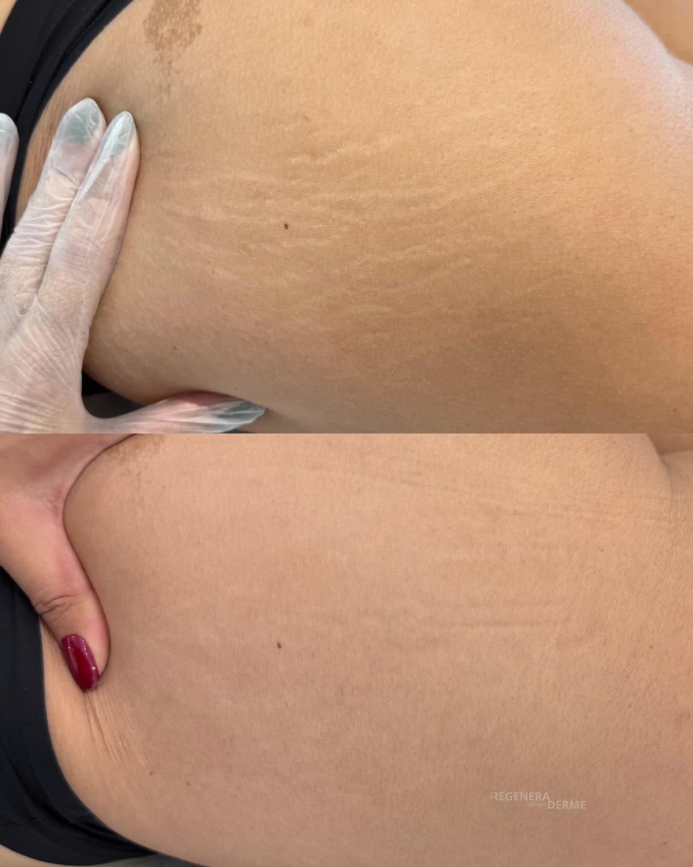 Antes e depois do tratamento