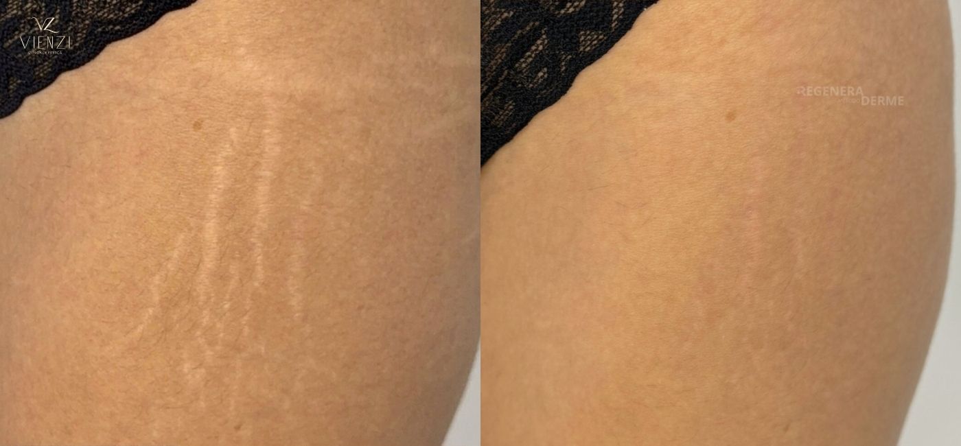 Antes e depois do tratamento 3