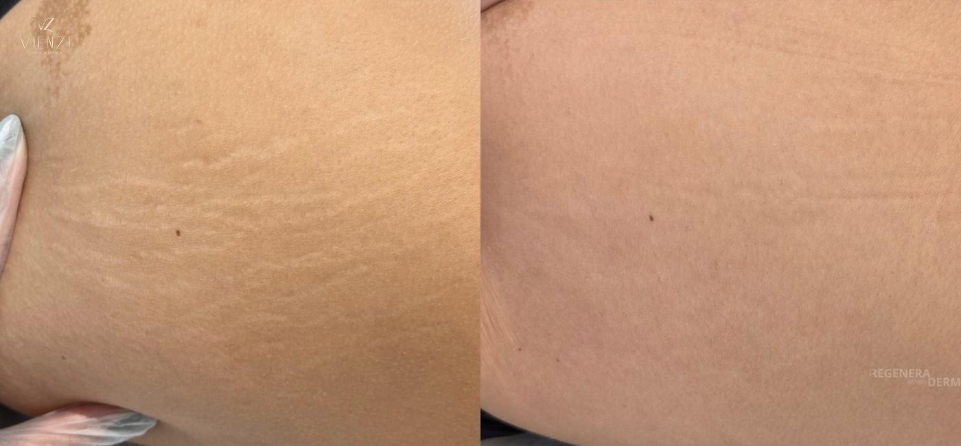Antes e depois do tratamento 5